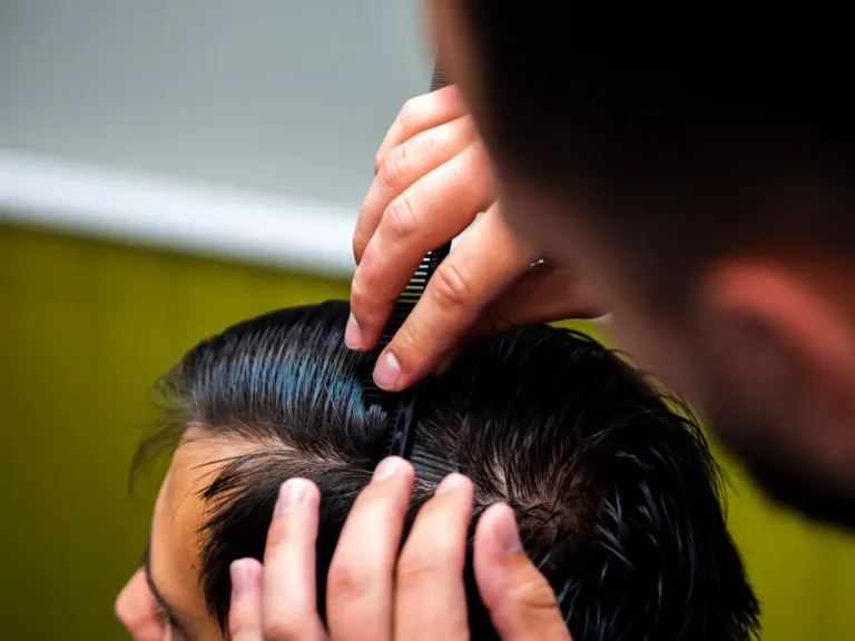 Dandruff Treatment